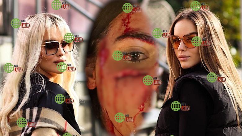 Dhunuan rëndë 24-vjeçaren në një restorant të Tiranës, policia shpall në kërkim Antolena Berishën dhe motrën e saj