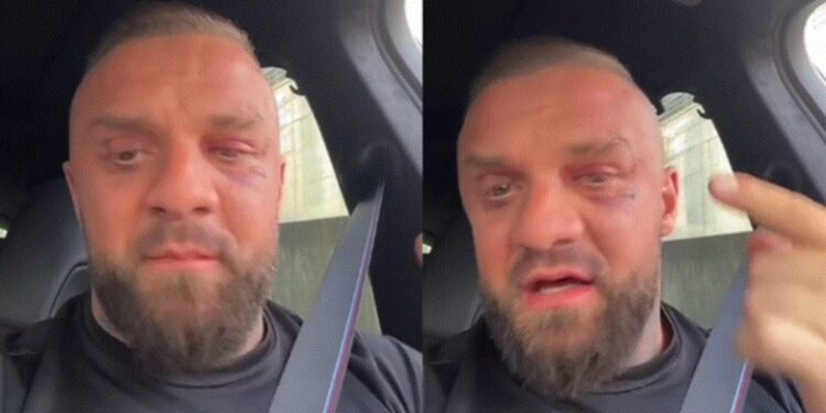 U rrah brutalisht nga Noizy dhe grupi i tij/ Me shenja në fytyrë, Medi Iseni del dhe flet publikisht për herë të parë