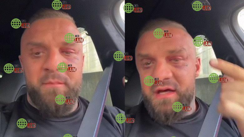 U rrah brutalisht nga Noizy dhe grupi i tij/ Me shenja në fytyrë, Medi Iseni del dhe flet publikisht për herë të parë