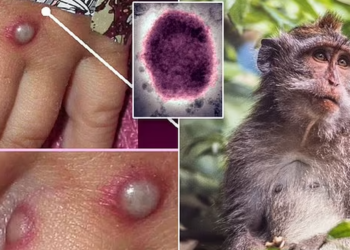 Çfarë është lia e majmunit?