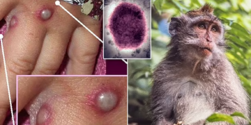 Çfarë është lia e majmunit?